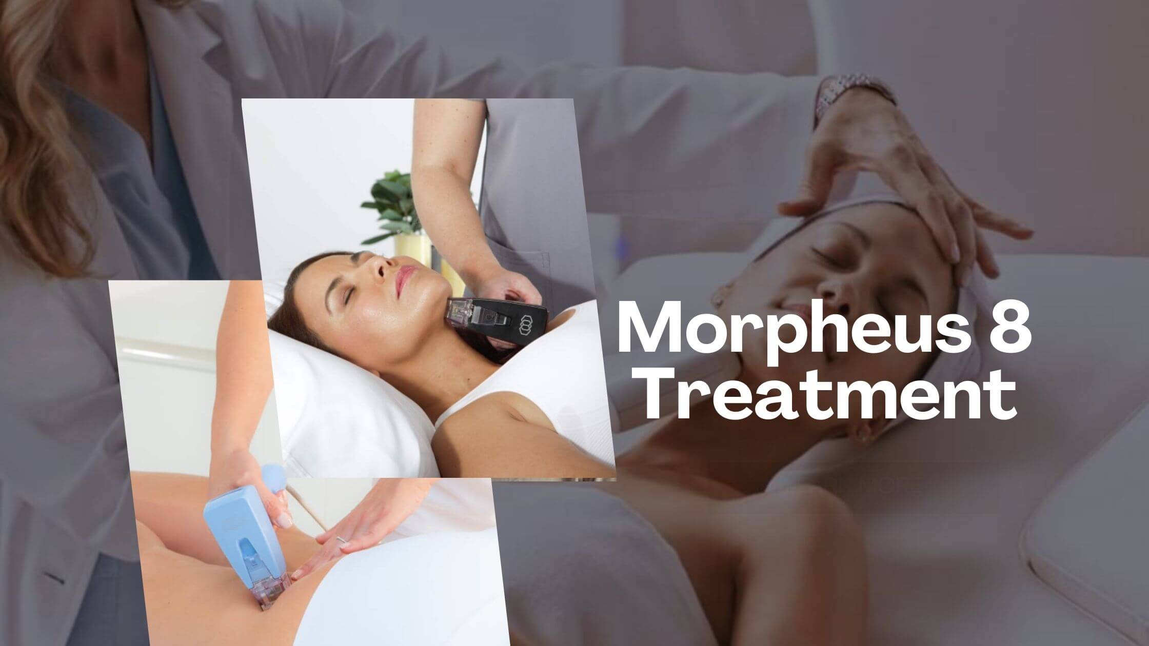 Morpheus 8 Treatment